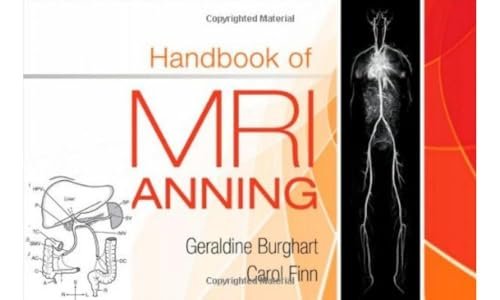 Handbook of MRI Scanning: Step-by-Step Protocols for Diagnostic Imaging