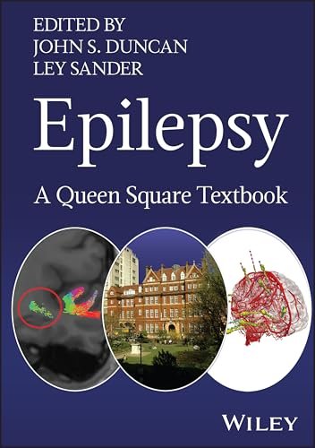Epilepsy: A Queen Square Textbook (First Edition) – Comprehensive Adult Epilepsy Guide