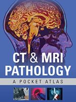 CT & MRI Pathology: A Pocket Atlas, 3rd Edition - eBook