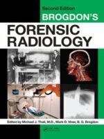 Brogdon's Forensic Radiology - Second Edition